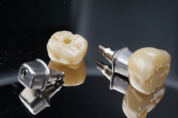 How Easy Is It To Replace An Implant Crown?